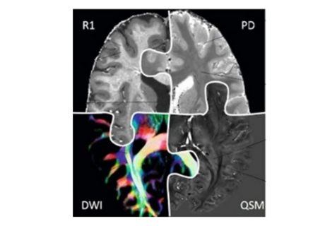 Microstructure MRI Research Group
